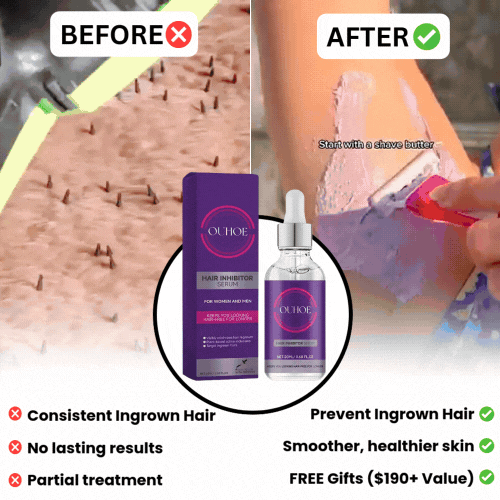 Prevent The Ingrown Hair With Natural After-Shave Serum! (One-Time Offer)